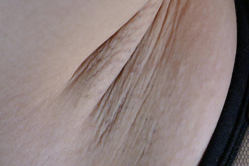 【脇の下接写エロ画像】女子の汗ばんだ脇の下をマクロ撮影！！どアップで脇毛の処理跡も見られる脇の下接写のエロ画像集！ww【80枚】 32